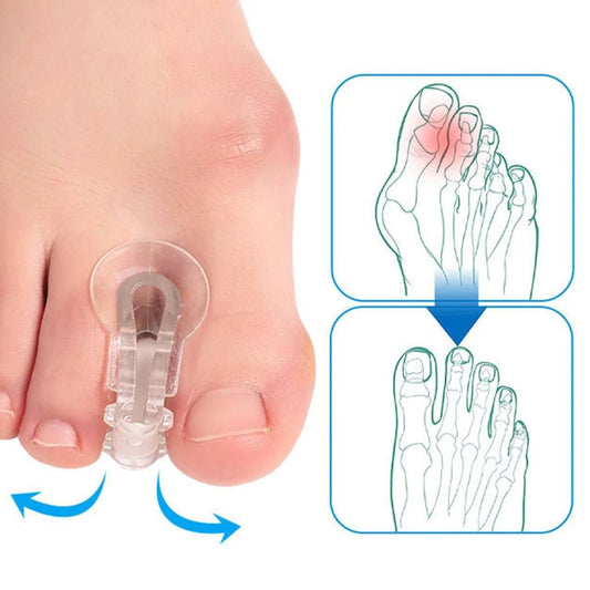SEPARADOR Y CORRECTOR DE DEDOS PARA JUANETES